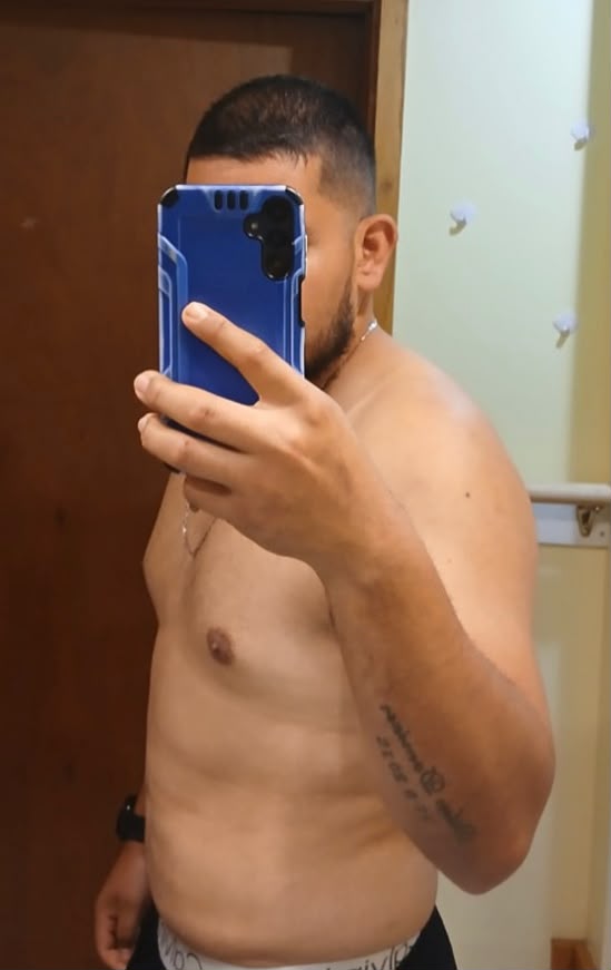 Rafael después de su transformación