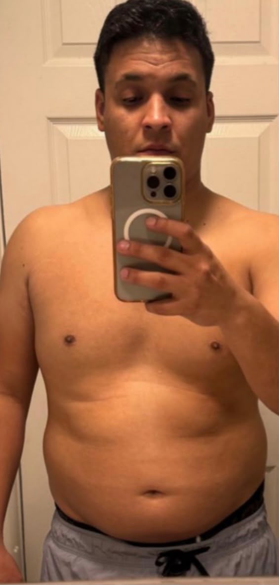 Fernando antes de su transformación